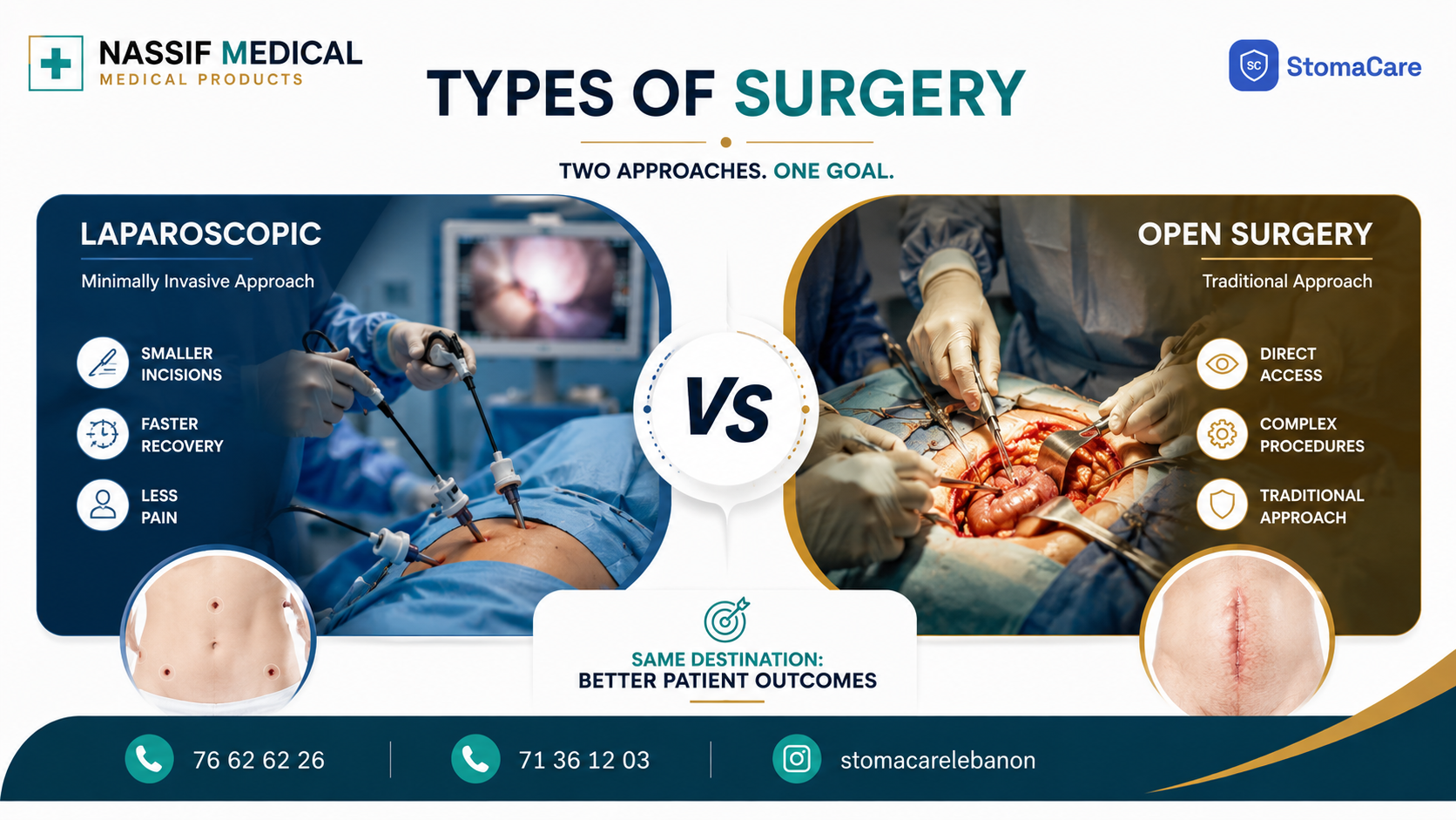 Types of surgery
